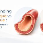 Hard Plaque vs. Soft Plaque: Understanding What Is Really Happening Inside Your Arteries