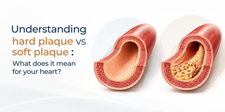 Hard Plaque vs. Soft Plaque: Understanding What Is Really Happening Inside Your Arteries